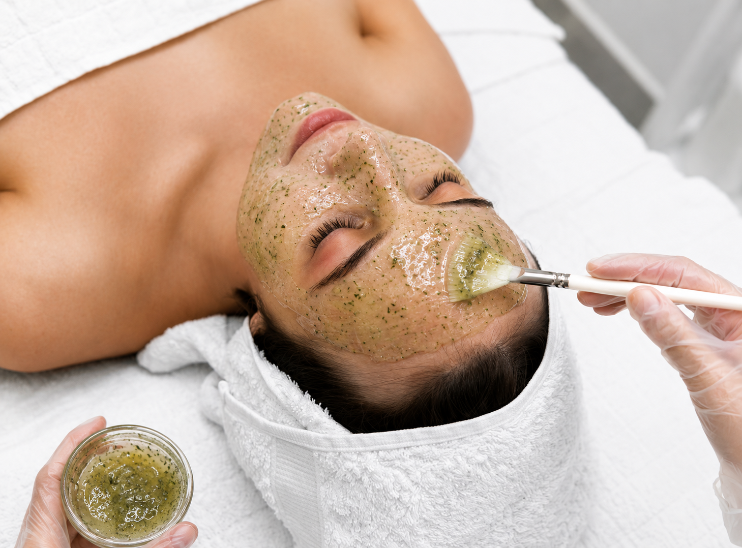 Green Peel Treatment